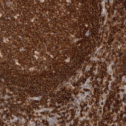 RUNDC1 Antibody, Novus Biologicals 25 &mu;L; Unlabeled:Antibodies, Polyclonal