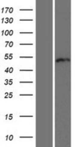 Novus Biologicals&trade;&nbsp;RUNDC3B Overexpression Lysate