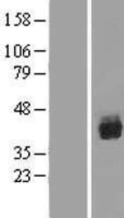 Novus Biologicals&trade;&nbsp;RUNX1/CBFA2 Overexpression Lysate