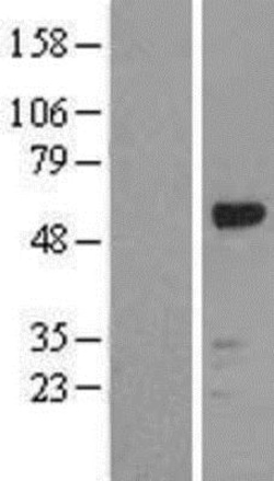 Novus Biologicals&trade;&nbsp;RUNX1/CBFA2 Overexpression Lysate