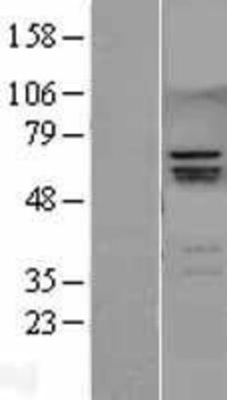 Novus Biologicals&trade;&nbsp;RUNX2/CBFA1 Overexpression Lysate