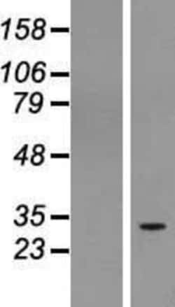 Novus Biologicals™ RUSC1 antisense RNA 1 Overexpression Lysate