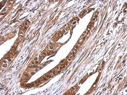RUVBL1 Antibody, Novus Biologicals 0.1mL; Unlabeled:Antibodies, Polyclonal