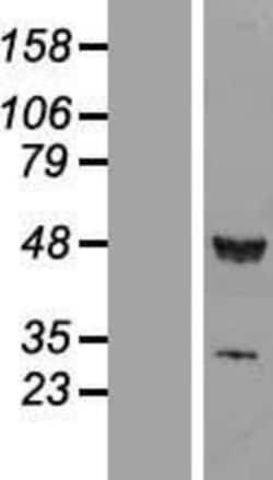 Novus Biologicals&trade;&nbsp;RUVBL1 Overexpression Lysate