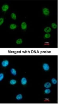 RUVBL2 Antibody, Novus Biologicals 0.1mL; Unlabeled:Antibodies, Polyclonal