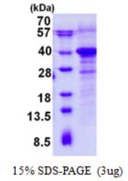 Novus Biologicals&trade;&nbsp;Recombinant Human RWDD1 His Protein