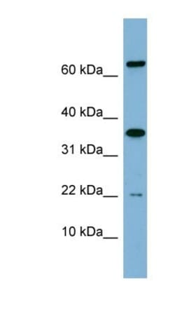 RWDD1 Antibody, Novus Biologicals:Antibodies:Primary Antibodies