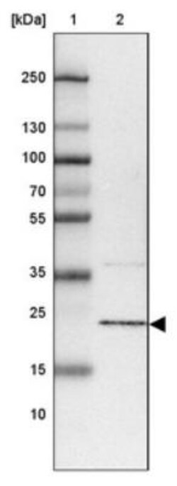 RWDD1 Antibody, Novus Biologicals 0.1mL; Unlabeled:Antibodies, Polyclonal