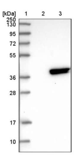 RWDD2A Antibody, Novus Biologicals 25ul | Buy Online | Novus Biologicals | Fisher Scientific
