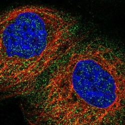 RWDD2B Antibody, Novus Biologicals:Antibodies:Primary Antibodies