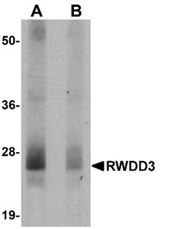 RWDD3 Antibody - BSA Free, Novus Biologicals 0.025 mg | Buy Online | Novus Biologicals | Fisher Scientific