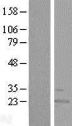 Novus Biologicals&trade;&nbsp;RWDD4A Overexpression Lysate