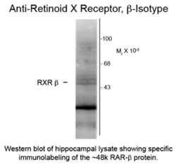 RXR beta/NR2B2 Antibody (147), Novus Biologicals 0.1mL; Unlabeled:Antibodies,