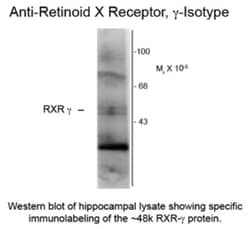 RXR gamma/NR2B3 Antibody (1373), Novus Biologicals 0.1 mL | Buy Online | Novus Biologicals | Fisher Scientific