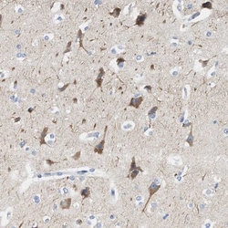 Ryanodine Receptor 2 Antibody, Novus Biologicals 0.1mL; Unlabeled:Antibodies,