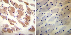 Ryanodine Receptor Antibody (34C) - BSA Free, Novus Biologicals 100 &mu;L | Buy Online | Novus Biologicals | Fisher Scientific