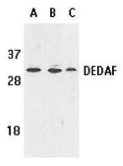 RYBP/DEDAF Antibody - BSA Free, Novus Biologicals 0.1 mg | Buy Online | Novus Biologicals | Fisher Scientific
