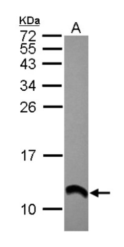 S100A2 Antibody, Novus Biologicals 0.1mL; Unlabeled:Antibodies, Polyclonal