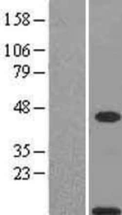 Novus Biologicals&trade;&nbsp;S100A11 Overexpression Lysate