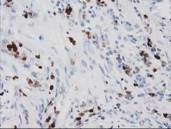 EN-RAGE/S100A12 Antibody (OTI1D1), Novus Biologicals 0.1mL; Unlabeled:Antibodies,