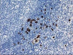 EN-RAGE/S100A12 Antibody (OTI1D1), Novus Biologicals 0.1mL; Unlabeled:Antibodies,