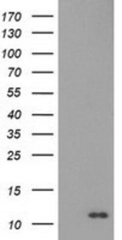 EN-RAGE/S100A12 Antibody (OTI1D1), Novus Biologicals 0.1mL; Unlabeled:Antibodies,