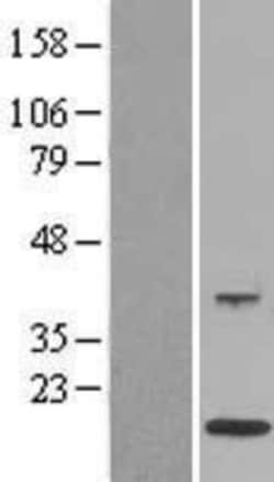 Novus Biologicals&trade;&nbsp;EN-RAGE/S100A12 Overexpression Lysate