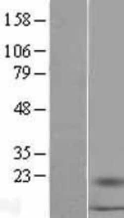 Novus Biologicals&trade;&nbsp;S100A16 Overexpression Lysate