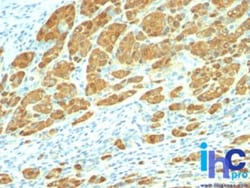 S100B Antibody (4C4.9), Novus Biologicals:Antibodies:Primary Antibodies