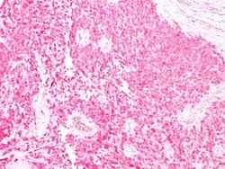 S100B Antibody (4C4.9), Novus Biologicals:Antibodies:Primary Antibodies