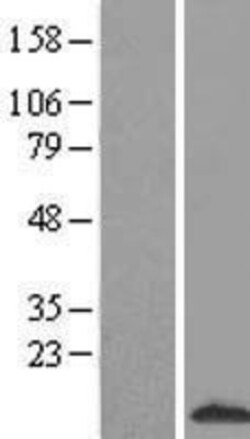 Novus Biologicals&trade;&nbsp;S100A3 Overexpression Lysate