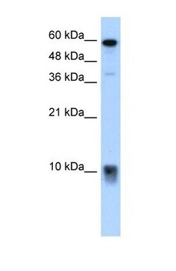 S100A3 Antibody, Novus Biologicals 0.1mg; Unlabeled:Antibodies, Polyclonal