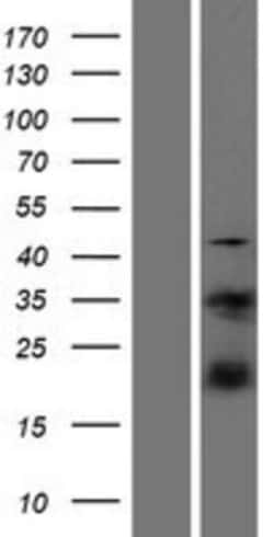 Novus Biologicals&trade;&nbsp;S100A4 Overexpression Lysate