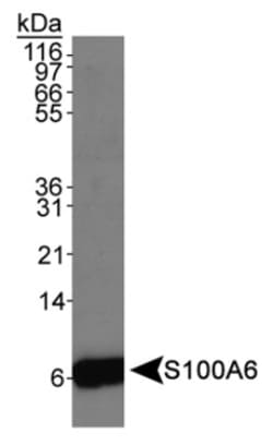 S100A6 Antibody, Novus Biologicals 0.025mL; Unlabeled:Antibodies, Polyclonal