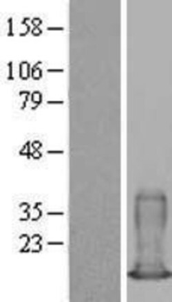 Novus Biologicals&trade;&nbsp;S100A6 Overexpression Lysate