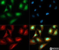 S100A6 Antibody, Novus Biologicals 0.025mL; Unlabeled:Antibodies, Polyclonal