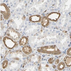 S100A6 Antibody, Novus Biologicals:Antibodies:Primary Antibodies