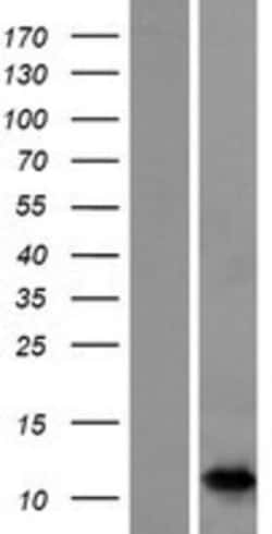 Novus Biologicals&trade;&nbsp;S100A7A Overexpression Lysate
