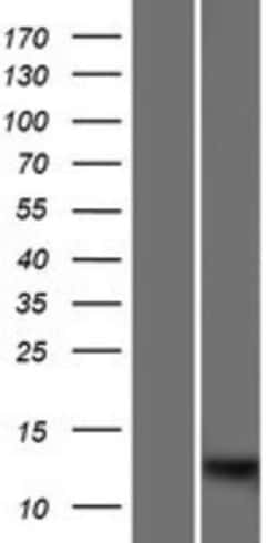 Novus Biologicals&trade;&nbsp;S100A7L2 Overexpression Lysate
