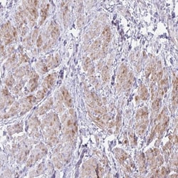 S100A7L2 Antibody, Novus Biologicals 25 &mu;L, Unlabeled:Antibodies, Polyclonal