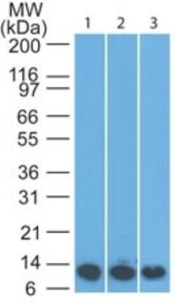 S100A8 Antibody (63N13G5) - BSA Free, Novus Biologicals 0.025 mg | Buy Online | Novus Biologicals | Fisher Scientific