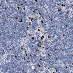 S100A8 Antibody, Novus Biologicals:Antibodies:Primary Antibodies