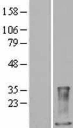 Novus Biologicals&trade;&nbsp;S100A9 Overexpression Lysate