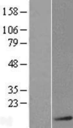 Novus Biologicals&trade;&nbsp;S100B Overexpression Lysate