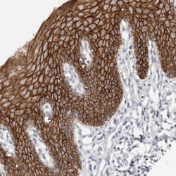 S100 calcium binding protein A14 Antibody, Novus Biologicals 0.1mL; Unlabeled:Antibodies,
