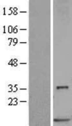 Novus Biologicals&trade;&nbsp;S100P Overexpression Lysate