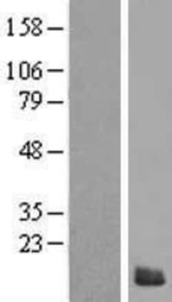 Novus Biologicals™ S100Z Overexpression Lysate