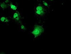 p70 S6 Kinase/S6K Antibody (OTI1G4), Novus Biologicals 0.1mL; Unlabeled:Antibodies,