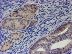 p70 S6 Kinase/S6K Antibody (OTI1G4), Novus Biologicals 0.1mL; Unlabeled:Antibodies,
