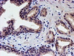 p70 S6 Kinase/S6K Antibody (OTI1G4), Novus Biologicals 0.1mL; Unlabeled:Antibodies,